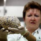 Vitát indítanak Csehországban, hogy mi legyen a sorsa Palacky agyának