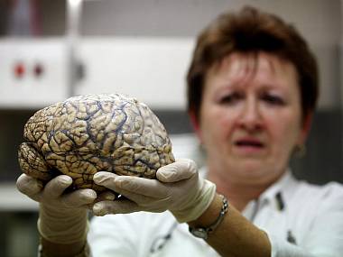 Csehországban ő volt az Agy