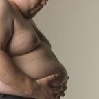 Egészségfelmérés: sok túlsúlyos rosszul ítéli meg az állapotát