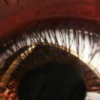 Újra lát a kínai férfi, akinek sertésszaruhártyát ültettek a szemébe