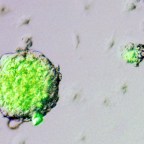 Súlyos betegséget okoz, ha nem működik a “szemételtakarítás” a sejtekben