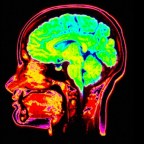 A mediterrán étrend jótékony hatással lehet az idős emberek agyának egészségére