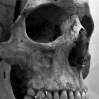 Évekkel ezelőtti emberölést derítettek fel csontmaradványok alapján 